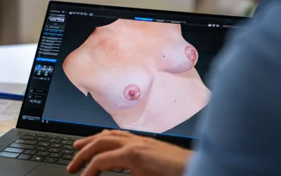3D-Brustsimulation: Vorher-Nachher-Ergebnis Ihrer Brustvergrößerung mithilfe der 3D Simulation schon vorab sehen